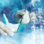 SPONDYLOPLASTIKH 2
